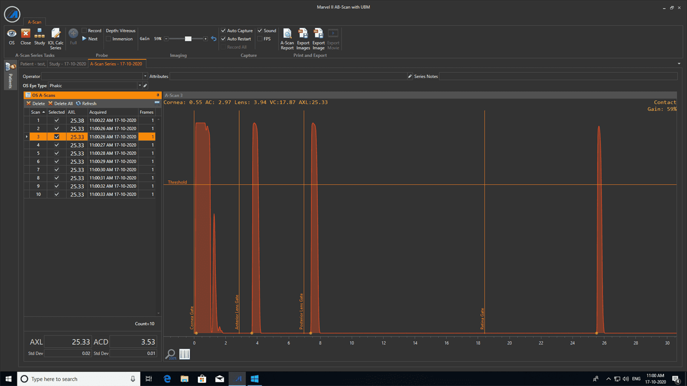 Appasmy AB Scan 2 Precision Ophthalmic Imaging in Ethiopia